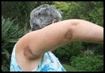 White woman attacked on StWinifred KZN beach 26Jan2011