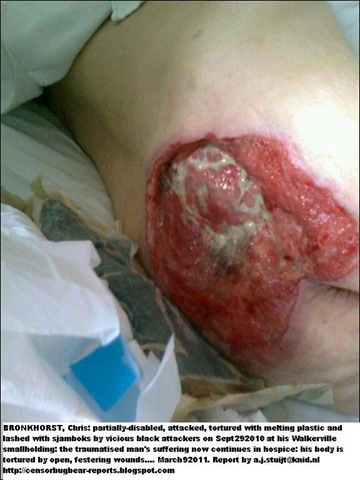 [BRONKHORST Chris pressure wounds maltreatment hospice dies May242011[6].jpg]