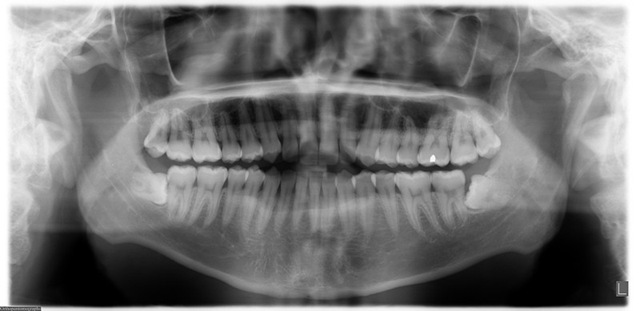 [dental-xray-opg[3].jpg]