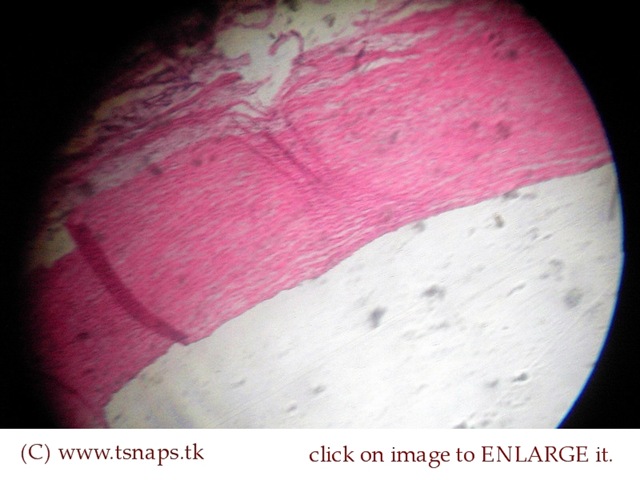 [Elastic artery histology slide[2].jpg]