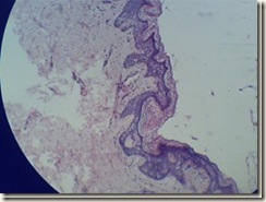Stratified squmous keratinized epithelium microscope view_thumb