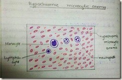 hypchromic microcytic anemia H&E diagram