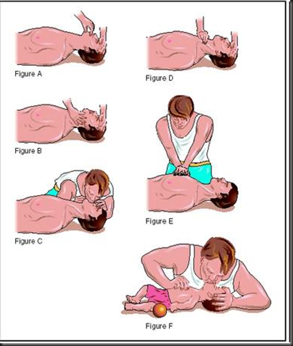 Cardiopulmonary Resuscitation (CPR) | studynursing