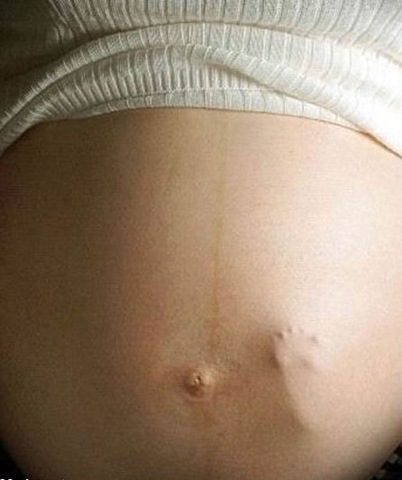 [embarazada con el pie del bebe en la panza[3].jpg]