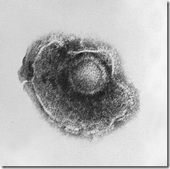 Infeksi, penyebab, cara penularan dan Penanganan Virus Varicella