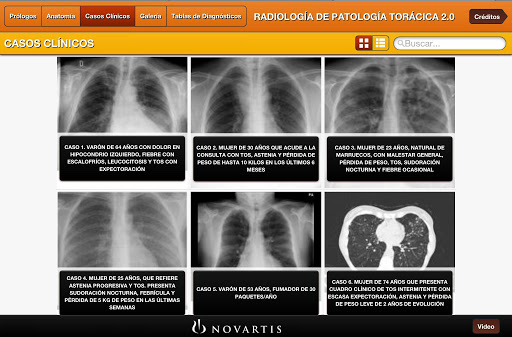 免費下載醫療APP|Radiología Patología Torácica app開箱文|APP開箱王