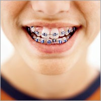 [orthodontics[2].jpg]
