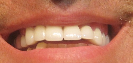 [teeth 019[4].jpg]