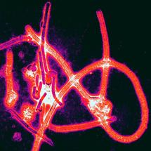 Relatives of Ebola are among the 'fossil viruses' researchers have identified. Image: Thomas W Geisbert