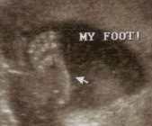 [Baby Gril November 16 2009 foot[4].jpg]