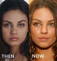 Mila Kunis Plastic Surgery on Mila Kunis Plastic Surgery Before And After Photos And Video   Mila