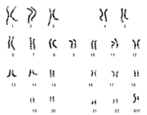 Chromosomes Chromosomes
