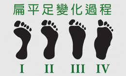 图 1 - 扁平足的脚印
