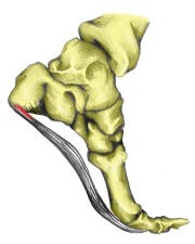 [180plantar_fasciitis[3].jpg]