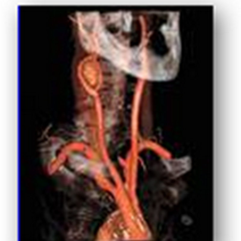 US medical Isotope Shortage Getting Worse – Update