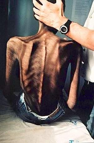 [Gideon Mendel - La sofferenza (malato di aids in Sudafrica)[4].jpg]