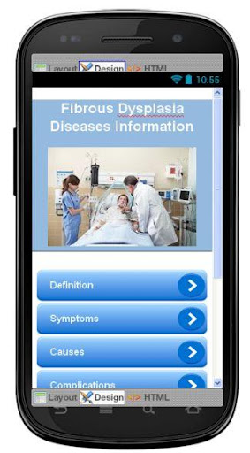 Fibrous Dysplasia Information