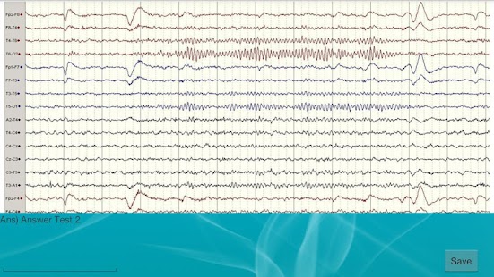 How to mod EEG tutor patch 0.2 apk for laptop