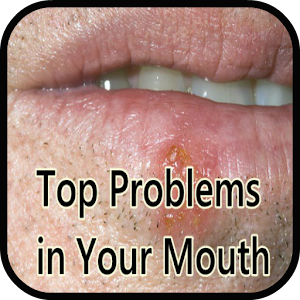 Top Problems in Your Mouth.apk 1.0