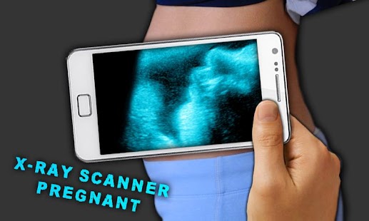 X射線掃描儀懷孕