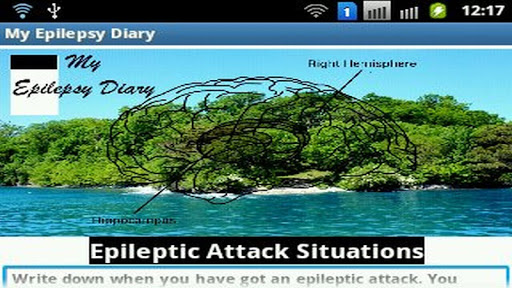 My Epilepsy Diary