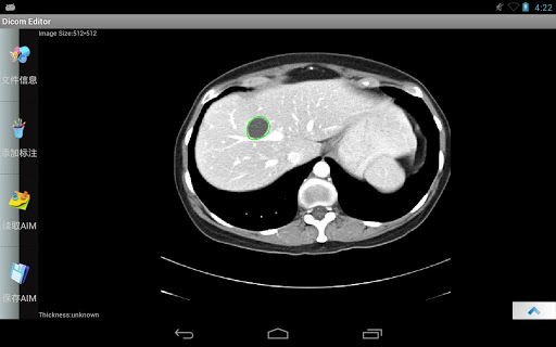 【免費醫療App】Dicom 图像编辑器-APP點子