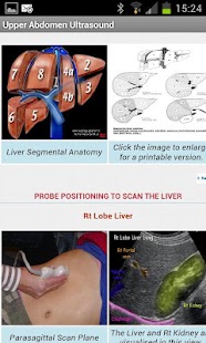 How to mod Upper Abdominal Ultrasound 1.0 apk for pc