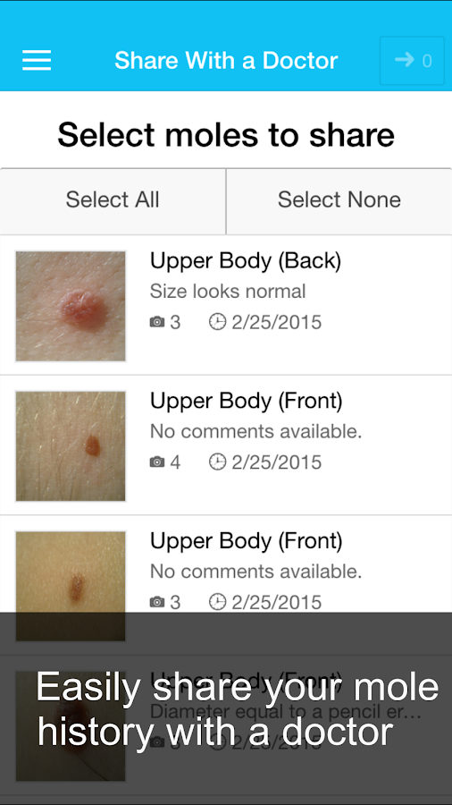    Skin Cancer App - MySkinPal- screenshot  