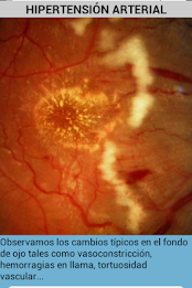 ophthalmology poster 15