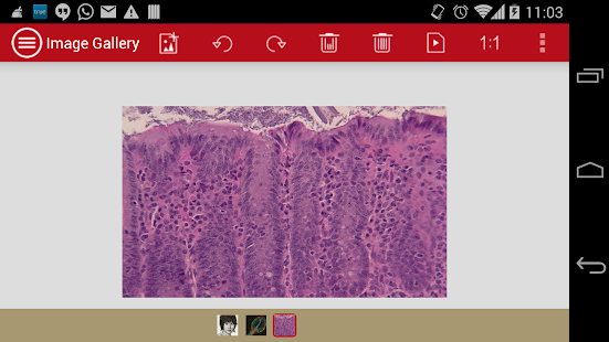 mVision Demo Screenshots 7