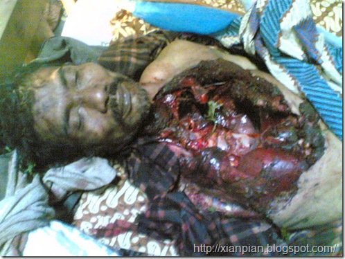 Korban01