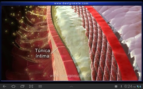 Aterosclerose Screenshots 1
