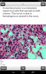 How to get USMLE Step 2 CK Cards Lite 2.46 apk for android