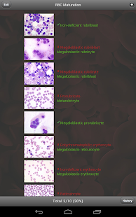 BYU Hematology Screenshots 5