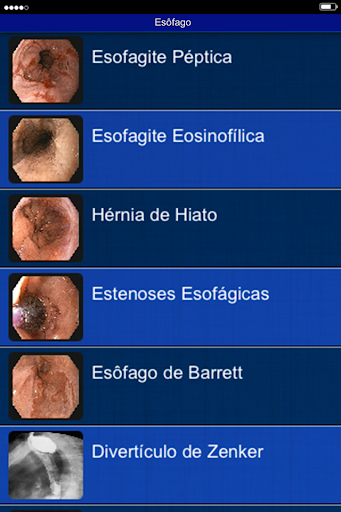 Endoscopia HCFMUSP