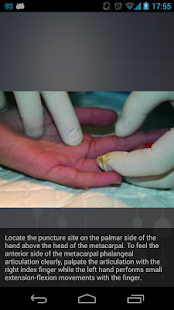 Free Download Med Procedures APK