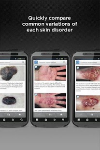 Dermatology DDx - screenshot thumbnail