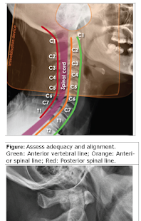 ATLS Trauma Guidelines Manual