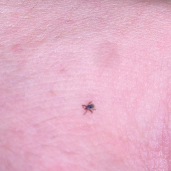 Sheep tick Project Noah