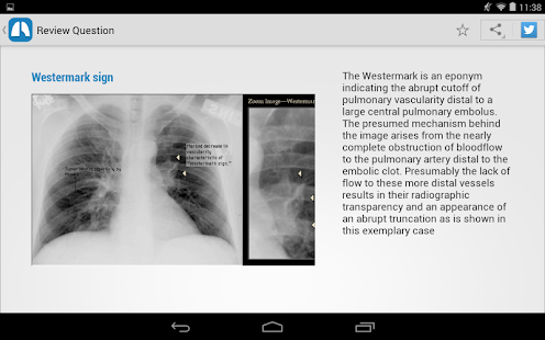 免費下載醫療APP|Chest X-Ray Training app開箱文|APP開箱王