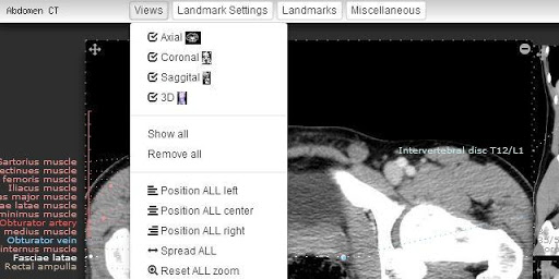 Imaging Anatomy - CT MRI XR US