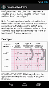 Free ECGsource APK