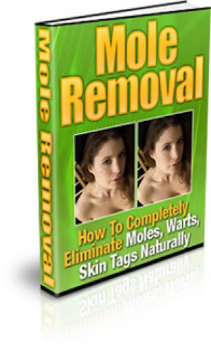 Remove Moles Warts Naturally