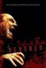 [Severed20052.jpg]