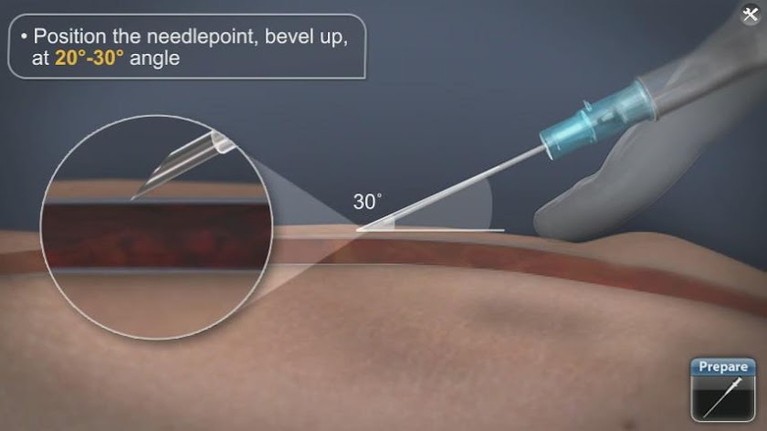 Medrills: Obtaining IV Access Screen 2