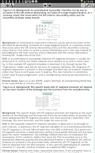 【免費醫療App】ECG Interpretation Everyone-APP點子