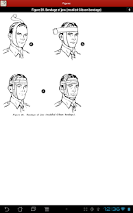 Bandaging and Splinting Screenshots 13