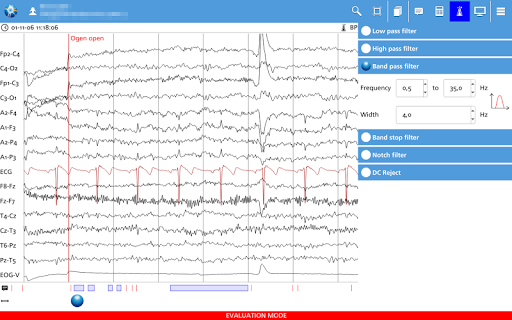 【免費醫療App】NeuroCenter EEG-APP點子