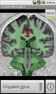 NeuroSlice