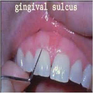Dental Probing App Hygienist 1.133